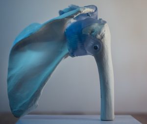 bone fracture personal training kitsilano