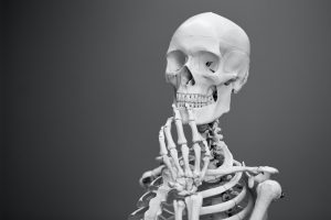 osteoporosis personal training