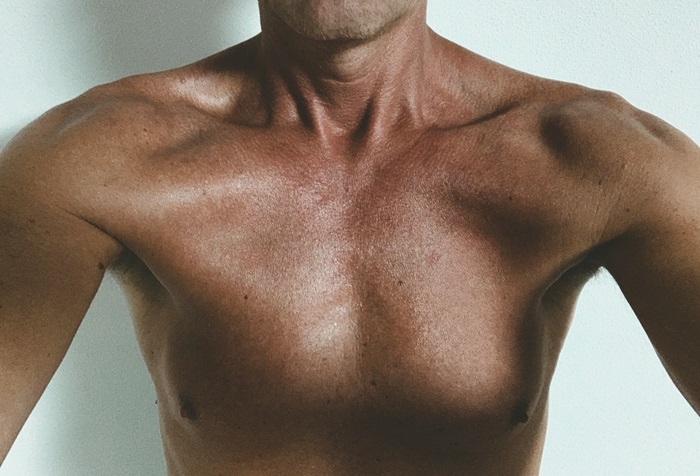 Shoulder Dislocation