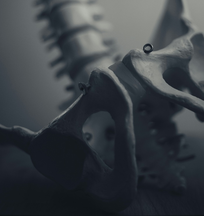 SI Joint Dysfunction